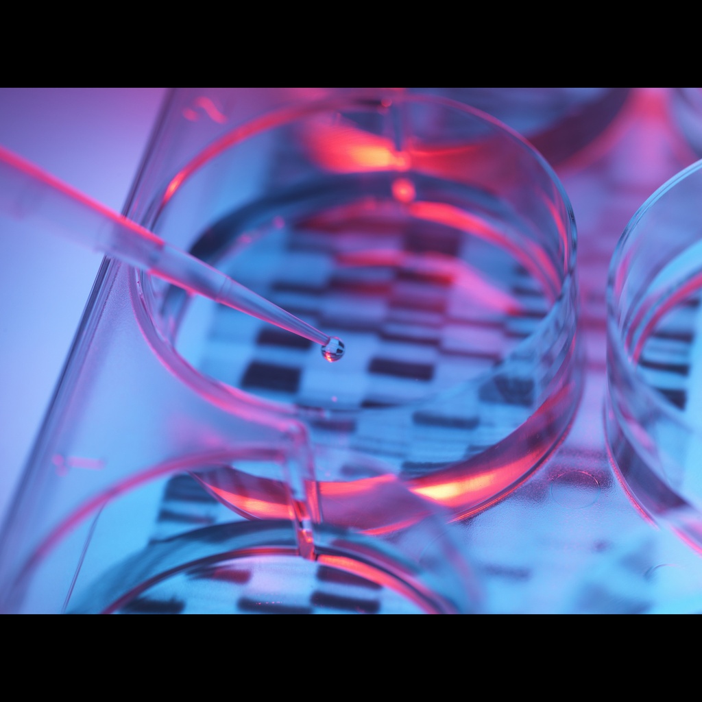Forensic DNA Fingerprinting Kit DNA evidence classroom study kit, includes DNA samples and standards, restriction enzymes, buffers, Fast Blast DNA stain, test tubes/holders, curriculum, and more, for 32 students, download free manual