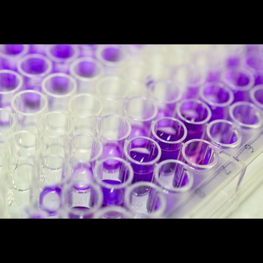 [SEA133Bo-kit] Bovine  Cattle  ELISA Kit for Tumor Necrosis Factor Alpha  TNFa , Assay